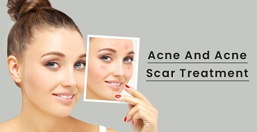 Skin Treatment in Ahmedabad